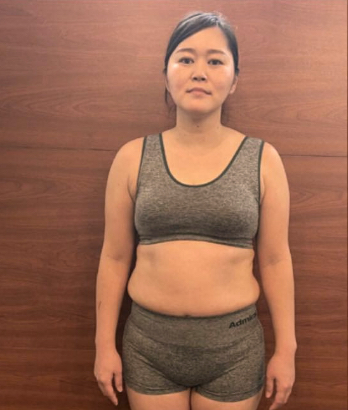 フロント ビフォー写真 女性