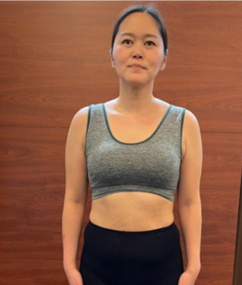 フロント アフター写真 女性