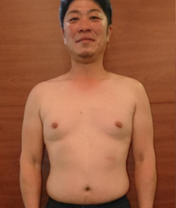 フロント ビフォー写真 男性
