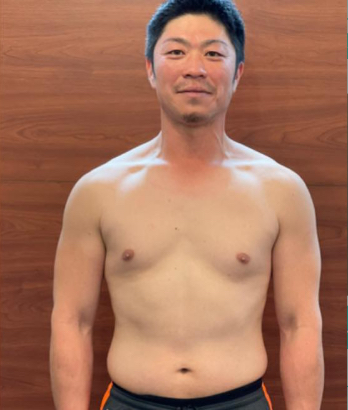 フロント アフター写真 男性